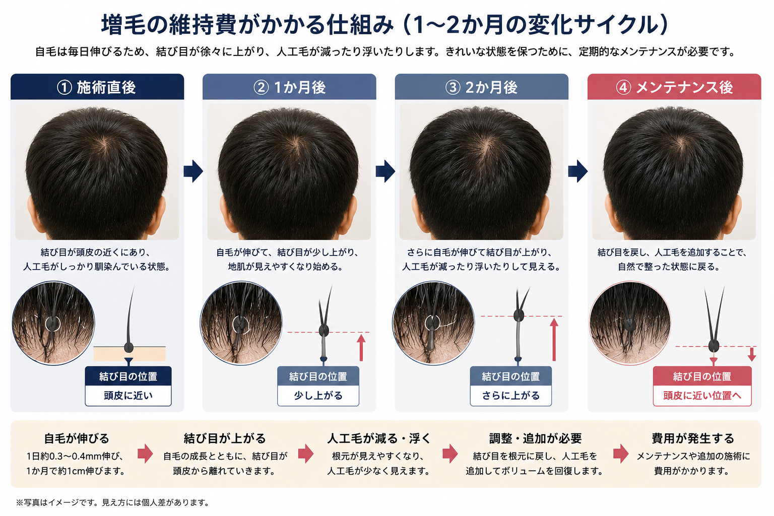 増毛の維持費が発生する仕組み。施術直後→自毛が伸びて結び目が浮く→人工毛が減る→メンテナンスで再び整う、という1〜2か月のサイクルを示したイメージ